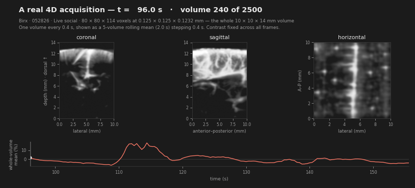 An animation of a real four-dimensional functional ultrasound acquisition: coronal, sagittal and horizontal planes through the same 10 by 10 by 14 millimetre volume updating together across 150 volumes, with a cursor tracking position along the whole-volume mean signal below.