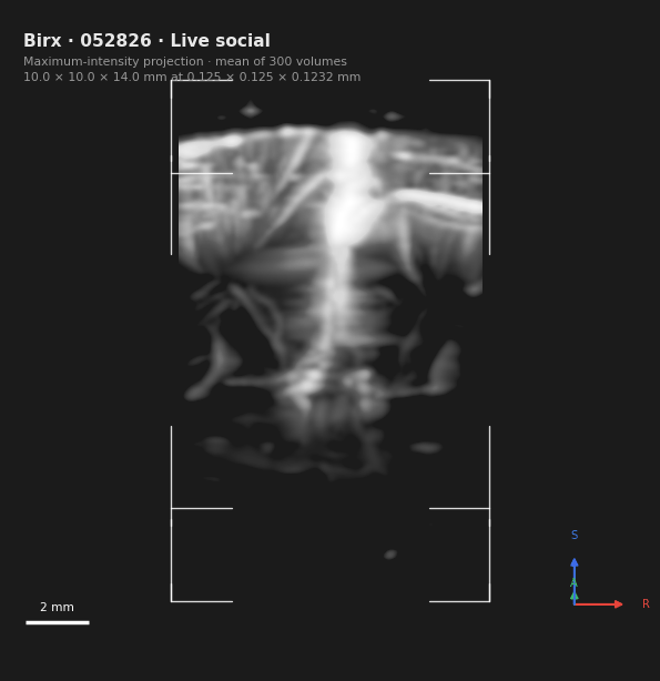 A rotating maximum-intensity projection of the marmoset vasculature, showing surface vessels and the arterioles that descend from them into cortex, turning through a full revolution.