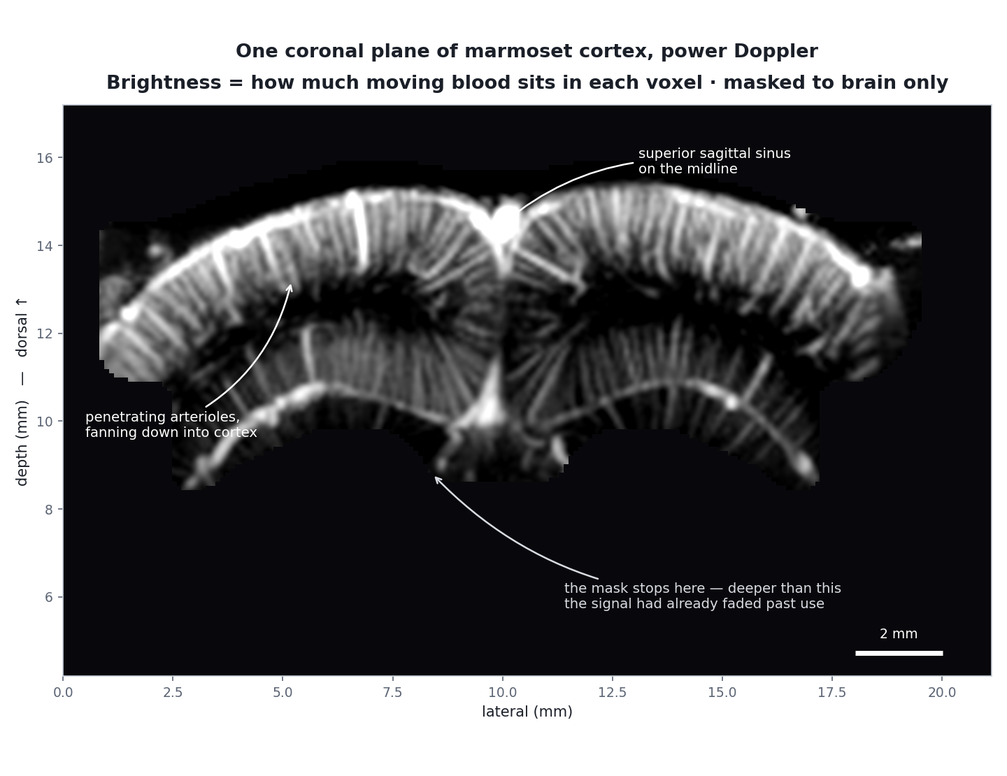 A coronal power-Doppler image of marmoset cortex, masked to the brain, showing the sagittal sinus at the midline and penetrating arterioles fanning down into cortex on both sides.