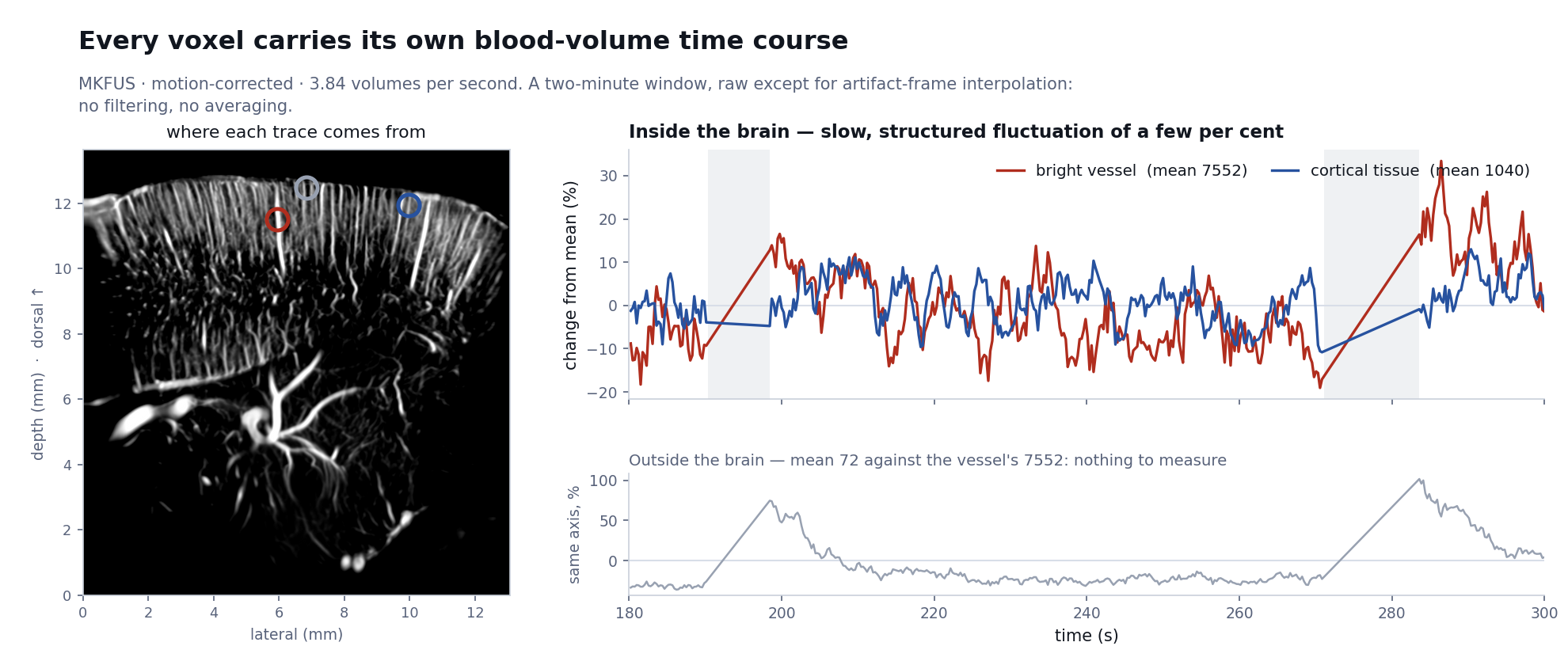 A coronal plane with three marked voxels and their power-Doppler time courses over a two-minute window: a vessel and a cortical voxel fluctuate by a few per cent with visible structure, while a voxel above the brain surface shows only low-level noise.